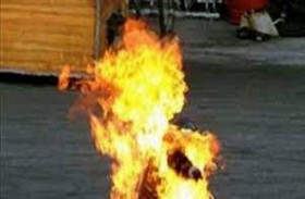 يحرق نفسه أمام عدسات الكاميرا