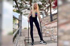 تدفع 164 ألف دولار لتطويل ساقيها