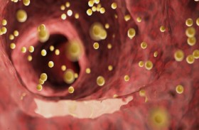 زيادات طفيفة على وجهك قد تدل على ارتفاع الكوليسترول في الدم!