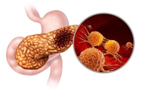 مستخلص طبيعي قد يكون سلاحا ضد سرطان البنكرياس