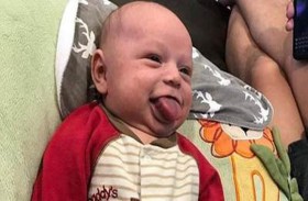 لسان طفل ينمو بلا توقف