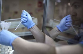 دراسة كبيرة: تراجع تركيز الحيوانات المنوية عالمياً