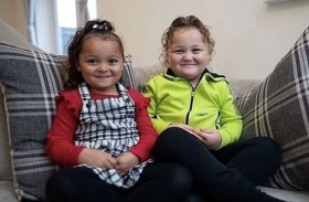 توأم تولدان بلونين مختلفين وتنموان في رحمين منفصلين