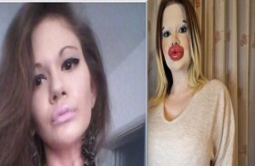 صاحبة أكبر شفاه في العالم  تبحث عن «الحب الحقيقي»