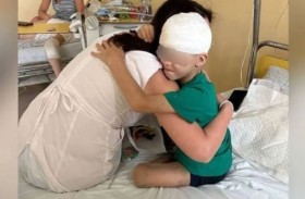 إعادة بناء وجه طفل مزقته الكلاب