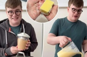 يثير الجدل بتحويل دهون جسمه إلى صابون