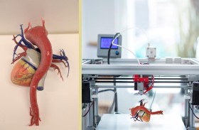 كليفلاند كلينك.. وضع خطة بالطباعة ثلاثية الأبعاد لعلاج تشوه في القلب