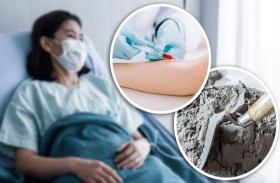 علاج غريب بالإسمنت يتسبب بوفاة امرأة