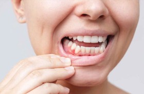 فوائد النظام المتوسطي تصل إلى صحة الفم واللثة