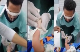 ممرض معصوب العينين يدخل رهانًا لتركيب كانيولا لرضيع