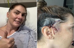 قصة شعر تنقذ حياتها من ورم في رأسها