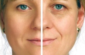 أسلحة فعالة لمحاربة التجاعيد