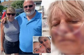 ترعى كلب الجيران.. وتموت بعضّة