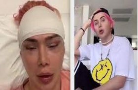 تجري 18 جراحة تجميلية لتصبح شبيهة بالكوريين