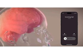 أول مريض خضع لزراعة شريحة ماسك الدماغية يتحدث عن تجربته