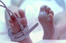 تضع مولودها حيا بعد إعلامها بوفاته في رحمها