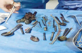 ملاعق ومسامير وموس حلاقة في معدة رجل