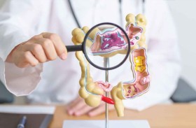 اختبار «ذكي» للكشف المبكر عن سرطان القولون