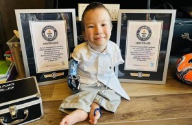 طفل أول حامل لطرف اصطناعي من ليغو