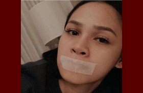 تضع لاصقاً على فمها أثناء النوم