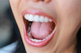 هل يكشف لسانك أسرار قلبك الصحية؟