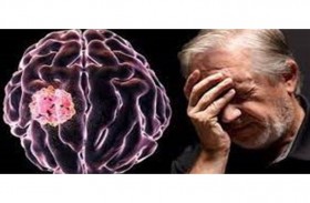 أيهما أقوى تأثيراً على الدماغ: الأحمر أم الأخضر؟