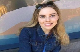 حالة نادرة تهدد شابة بانفصال جمجمتها