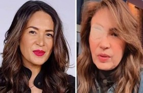 ما هو المرض الغريب الذي تعاني منه الممثلة المكسيكية يولاندا أندرادي؟