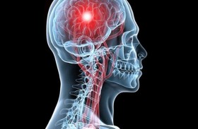 تحذير صحي مهم.. مُحَلٍّ شائع قد يزيد خطر السكتة الدماغية