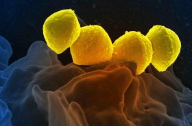 آكلة للحم.. بكتيريا في اليابان تقتل خلال 24 ساعة