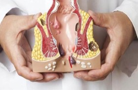 عوامل ترفع خطر تضخم البواسير   