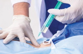 حقنة الظهر للولادة.. فوائد غير متوقعة