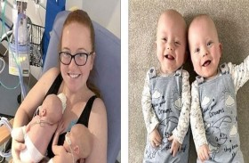 تنجب توأماً... على مدى يومين