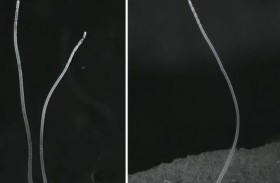 اكتشاف أكبر بكتيريا في العالم.. تُرى بالعين المجردة