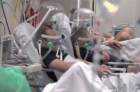 رصد أخطر مضاعفات كورونا