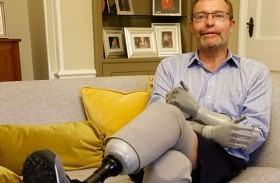 بُترت أطرافه الأربعة.. نائب بريطاني يعود إلى البرلمان