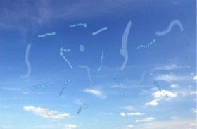 سبب خطير لظهور «الذباب» أمام العينين