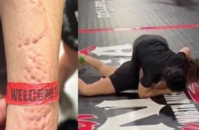 اعتداء وحشي.. لاعبة جوجتسو تعض منافستها خلال مباراة