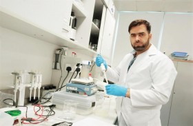 باحثون من جامعة الإمارات : مكونات حليب الإبل ذات فاعلية في مكافحة مرض السكري