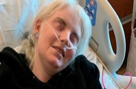 الطعام يتحول إلى كحول في جسمها