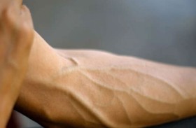 ما سر استمرار نمو شريان إضافي في أذرع البشر؟!