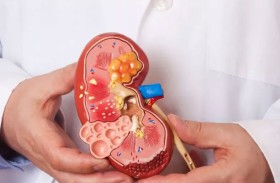 باحثون يكتشفون تغيرات جينية.. تزيد خطر سرطان الكلى