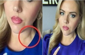 ملاحظة مشاهد تكشف إصابة مذيعة بالسرطان