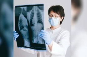 نتائج إيجابية لتجارب سريرية على لقاح علاجي لسرطان الرئة