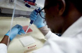 أطباء جزائريون ينفون تسبب الكلوروكين بأثار جانبية 