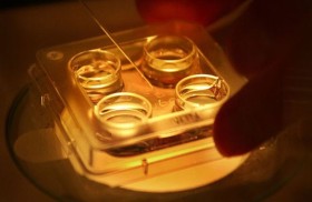 رابط مخيف بين أزمة كورونا وتجميد البويضات