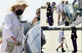 سيدة أميركا الأولى على عكاز.. ماذا جرى؟