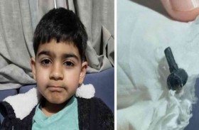 العثور على قطعة ليغو داخل أنف طفل