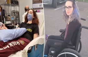 مرض دماغي غامض أصاب المئات.. والحالات في تزايد