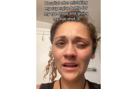 استخدمت الغراء بدلاً من القطرة.. فكانت النتيجة كارثية